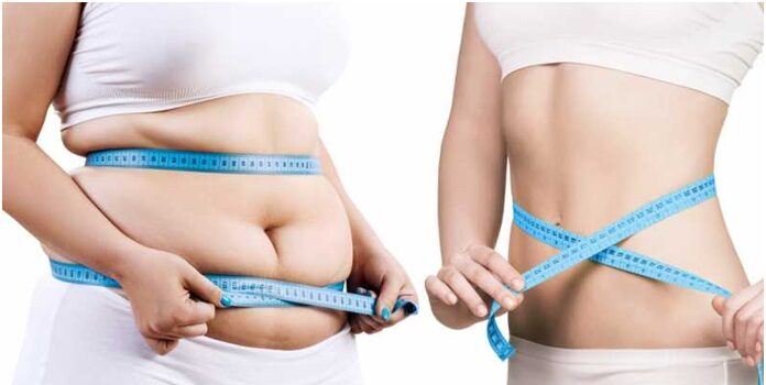 Anyone can access weight-loss treatment- True or not